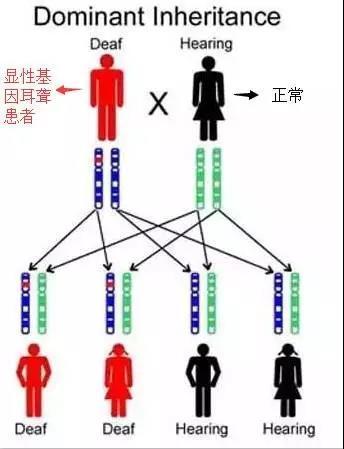 耳聋基因检测有必要吗？(图1)